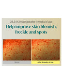 [Goodal] Green Tangerine Vita C Dark Spot Care Sun Serum (50Ml/1.69fl.oz)