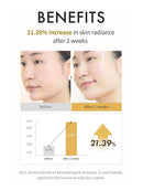 [REJURAN] Turnover Ampoule c-PDRN 0.5% (30ML/1.01fl.oz)