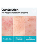 [MEDIHEAL] Madecassoside Blemish Repair Serum (40ml/1.35fl.oz)