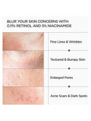 Anua Retinol 0.3% + Niacin Renewing Serum 30Ml