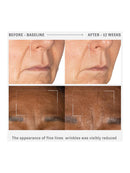 [OHUI] Reverse Activator Retinol Fine Wrinkle Serum (50ml/1.69fl.oz)
