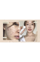 NOTS Centella Scar Ointment [Ylang-Ylang] 15g