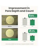 [AXIS-Y] Mugwort Pore Clarifying Wash Off Pack (100ml/3.38fl.oz)