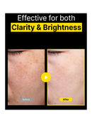 [DIFFER&DEEPER] C-Tox For Daily Shot (25Ml X10EA)