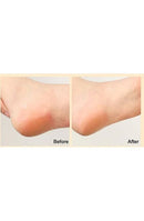 La Bonita Shea Butter Foot Peeling Mist 200Ml