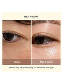[Meditherapy] Vita Real Toning Laser Cream (50Ml)