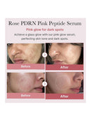[medicube] PDRN Pink Peptide Serum (30ml/1.01fl.oz)