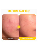 [TIRTIR] Pure Vitamin C24 Serum (30ml/1..01fl.oz)