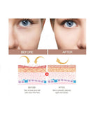 Prorance Anti-wrinkle Multi Balm 10G